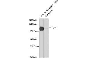 Western blot analysis of extracts of various cell lines, using TLR4 antibody (ABIN6134488, ABIN6149222, ABIN6149225 and ABIN6215119) at 1:1000 dilution. (TLR4 Antikörper  (AA 500-600))