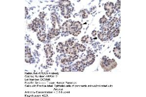 Immunohistochemistry (IHC) image for anti-X-Ray Repair Complementing Defective Repair in Chinese Hamster Cells 5 (Double-Strand-Break Rejoining) (XRCC5) (C-Term) antibody (ABIN2778271)