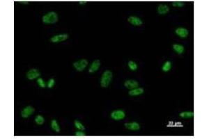Immunostaining analysis in HeLa cells. (PRPF8 Antikörper)