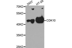 Western blot analysis of extracts of various cell lines, using CDK10 antibody (ABIN5975358) at 1/1000 dilution.