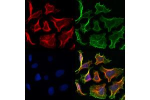 ABIN6260811 and ABIN6272991 staining Hela cells by IF/ICC. (CHMP2A Antikörper  (Internal Region))