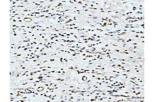 IHC analysis of ARL6IP6 using anti-ARL6IP6 antibody (ABIN7603020). (ARL6IP6 Antikörper  (Middle Region))