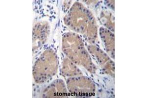 CA1 Antibody (N-term) immunohistochemistry analysis in formalin fixed and paraffin embedded human stomach tissue followed by peroxidase conjugation of the secondary antibody and DAB staining.