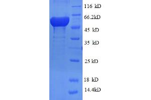 SDS-PAGE (SDS) image for Ribonucleotide Reductase M2 (RRM2) (AA 1-389), (full length) protein (His-SUMO Tag) (ABIN5710284) (RRM2 Protein (AA 1-389, full length) (His-SUMO Tag))