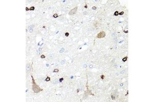 Immunohistochemistry of paraffin-embedded rat brain using IGFBP5 antibody (ABIN6292146) at dilution of 1:100 (40x lens).
