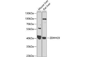 Western blot analysis of extracts of various cell lines, using ZDHHC9 antibody (ABIN6131130, ABIN6150420, ABIN6150421 and ABIN6223988) at 1:1000 dilution. (ZDHHC9 Antikörper  (AA 250-364))