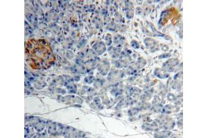 IHC-P analysis of Kidney tissue, with DAB staining. (ACVA Antikörper  (AA 44-178))