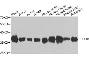 Western blot analysis of extracts of various cell lines, using LDHB antibody (ABIN5975613) at 1/1000 dilution. (LDHB Antikörper)