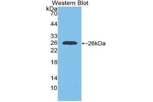Western Blotting (WB) image for anti-Insulin-Like Growth Factor 1 Receptor (IGF1R) (AA 763-955) antibody (ABIN1868503) (IGF1R Antikörper  (AA 763-955))
