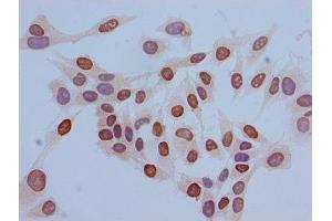 Immunocytochemistry analysis of Hela cells using ABIN7139669 at dilution of 1:100 (HIST1H3A Antikörper  (3meLys36))