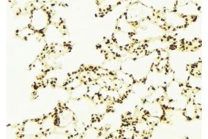 ABIN6272956 at 1/100 staining Mouse lung tissue by IHC-P. (C9ORF72 Antikörper  (Internal Region))