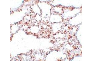 Immunohistochemistry of ZSCAN4 in rat lung tissue with this product at 5 μg/ml. (ZSCAN4 Antikörper  (C-Term))