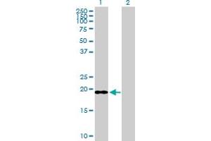 Western Blot analysis of ICT1 expression in transfected 293T cell line by ICT1 MaxPab polyclonal antibody. (ICT1 Antikörper  (AA 1-206))