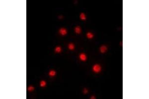 Immunofluorescent analysis of RBBP5 staining in Hela cells. (RBBP5 Antikörper)