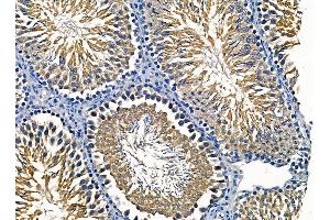 ABIN7095404 and ABIN7099461 at 1/100 staining rat testis tissue by IHC-P. (HS6ST2 Antikörper)