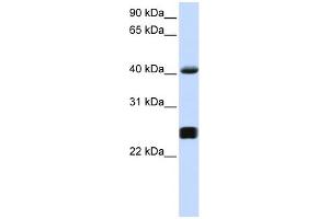 WB Suggested Anti-SERPINA3 Antibody Titration: 0.