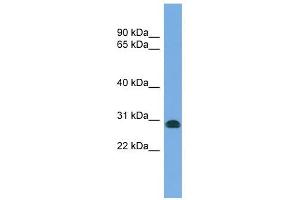 CENPH antibody used at 1 ug/ml to detect target protein. (CENPH Antikörper  (N-Term))
