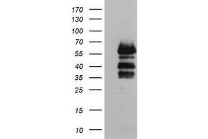Image no. 1 for anti-Vasodilator-Stimulated phosphoprotein (VASP) antibody (ABIN1501697)
