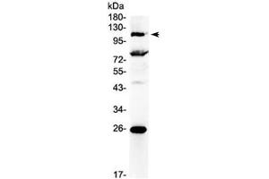 Western blot testing of human 22RV1 cell lysate with NFAT4 antibody at 0.
