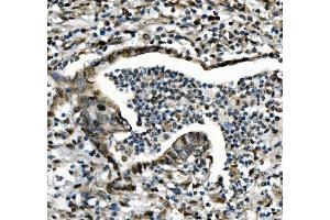 IHC analysis of CDC27 using anti-CDC27 antibody (ABIN7602163). (CDC27 Antikörper  (AA 609-824))