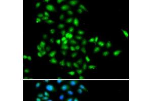 Immunofluorescence analysis of MCF-7 cells using SBDS Polyclonal Antibody (SBDS Antikörper)