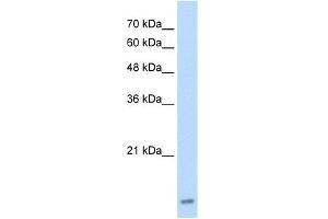 WB Suggested Anti-UBE2I Antibody Titration:  2. (UBE2I Antikörper  (Middle Region))