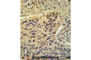 Immunohistochemistry (Paraffin-embedded Sections) (IHC (p)) image for anti-TAF2 RNA Polymerase II, TATA Box Binding Protein (TBP)-Associated Factor, 150kDa (TAF2) (AA 1159-1188), (C-Term) antibody (ABIN955066)