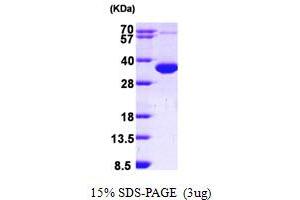 SDS-PAGE (SDS) image for Copper Chaperone For Superoxide Dismutase (CCS) (AA 1-274) protein (His tag) (ABIN667211)