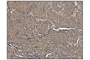 IHC analysis of Arginine Decarboxylase/AZIN2 using anti-Arginine Decarboxylase/AZIN2 antibody (ABIN7599403). (ADC Antikörper  (AA 1-448))