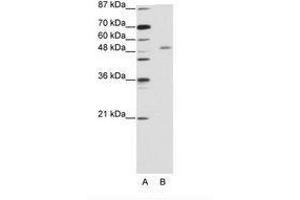 Image no. 1 for anti-Zinc Finger and SCAN Domain Containing 25 (ZSCAN25) (C-Term) antibody (ABIN203159) (Zinc Finger and SCAN Domain Containing 25 (ZSCAN25) (C-Term) Antikörper)