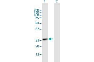 Western Blot analysis of KIAA1109 expression in transfected 293T cell line by KIAA1109 MaxPab polyclonal antibody. (Fetal Sulfoslycoprotein Antigen (FSA) (AA 1-191) Antikörper)