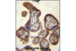 CGB/HCG-Beta Antibody (C-term) (ABIN656960 and ABIN2846144) immunohistochemistry analysis in formalin fixed and paraffin embedded human placenta tissue followed by peroxidase conjugation of the secondary antibody and DAB staining. (CGB Antikörper  (C-Term))
