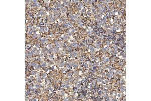 IHC analysis of SLC25A24 using anti-SLC25A24 antibody (ABIN7599228).