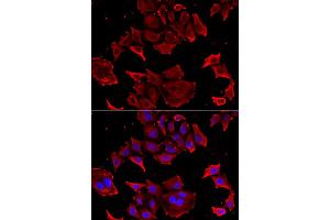 Immunofluorescence analysis of HeLa cell using TCAP antibody. (TCAP Antikörper)