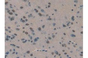 DAB staining on IHC-P; Samples: Rat Brain Tissue (SERPIND1 Antikörper  (AA 25-235))