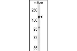 TI Antibody (N-term) (ABIN657533 and ABIN2846551) western blot analysis in mouse liver tissue lysates (35 μg/lane). (TIAM2 Antikörper  (AA 357-385))