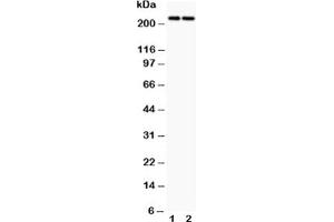 Western blot testing of Dicer antibody and Lane 1:  HeLa;  2: MCF-7 (DICER1 Antikörper  (AA 1-195))
