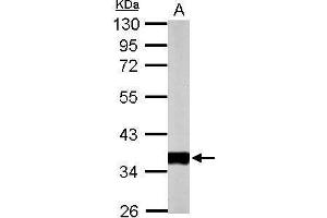 WB Image Sample (50 ug of whole cell lysate) A: mouse heart 10% SDS PAGE antibody diluted at 1:10000 (PDHE1-B Antikörper)