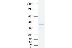 Western Blotting (WB) image for Sorting Nexin 16 (SNX16) (Transcript Variant 2) protein (Myc-DYKDDDDK Tag) (ABIN2732395)