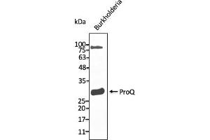Western Blotting (WB) image for anti-ProQ antibody (ABIN7272983) (ProQ Antikörper)