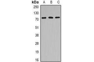 Western blot analysis of HSPA6 expression in Jurkat (A), mouse heart (B), rat brain (C) whole cell lysates. (HSPA6 Antikörper)
