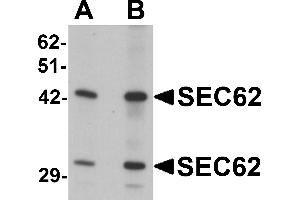 Western blot analysis of SEC62 in rat brain tissue lysate with SEC62 antibody at (A) 0. (SEC62 Antikörper  (C-Term))