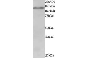 ABIN185009 staining (1µg/ml) of Jurkat lysate (RIPA buffer, 30µg total protein per lane). (USP11 Antikörper  (C-Term))