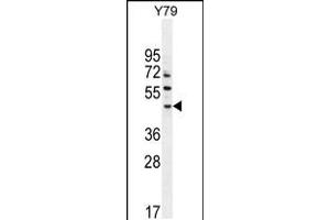 Western blot analysis in Y79 cell line lysates (35ug/lane). (LACE1 Antikörper  (N-Term))