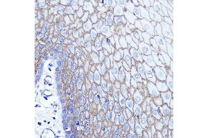 Immunohistochemistry of paraffin-embedded human esophageal using S100 Rabbit pAb (ABIN6128693, ABIN6147339, ABIN6147340 and ABIN6214636) at dilution of 1:100 (40x lens). (S100A14 Antikörper  (AA 1-104))