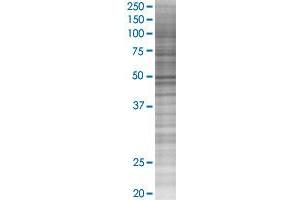 CYP2A7 transfected lysate.