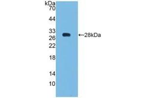 Detection of Recombinant Bcl2, Human using Polyclonal Antibody to B-Cell Leukemia/Lymphoma 2 (Bcl2) (Bcl-2 Antikörper  (AA 2-211))