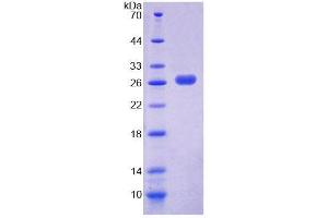 SDS-PAGE (SDS) image for Peroxisomal Biogenesis Factor 1 (PEX1) (AA 172-377) protein (His tag) (ABIN4989491) (PEX1 Protein (AA 172-377) (His tag))