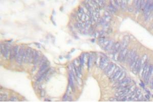 Image no. 1 for anti-Somatostatin (SST) antibody (ABIN271820) (Somatostatin Antikörper)
