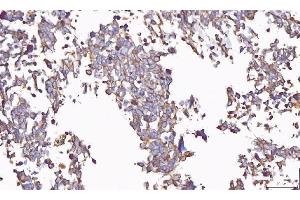 IHC analysis of PP11/ENDOU using anti-PP11/ENDOU antibody (ABIN7600552).
